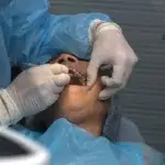 Patient undergoing oral surgery — when can I lift weights after tooth extraction.