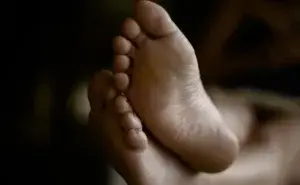 Runner showing flat feeet.